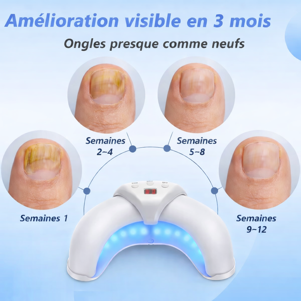 ZenLight™ Mini – Appareil compact pour le soin des ongles à domicile