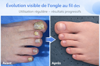 ZenLight™ Mini – Appareil compact pour le soin des ongles à domicile