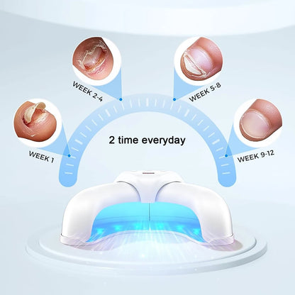 Home Nail Fungus Therapy Laser Device Hand and foot Anti Fungal Tools Onychomycosis instrument Repair Nail Fungus Light Device