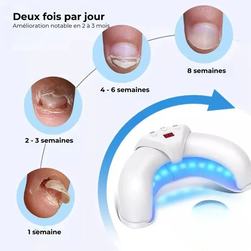 ZenLight™ Pro – Appareil compact pour le soin des ongles à domicile