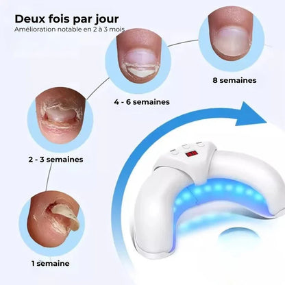 ZenLight™ Pro – Appareil compact pour le soin des ongles à domicile